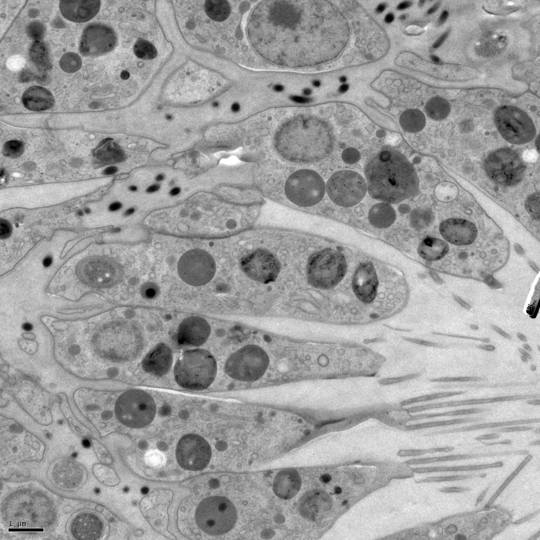 Electron microscopy slice from a choanocyte dataset